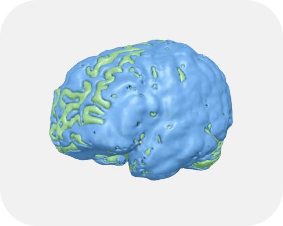 회백질, 백질 물성에 따른 분리